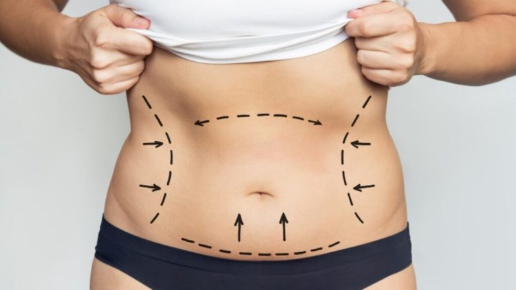 Essential Surgery Follow-Up Tips with Best Liposuction Surgeons in Dubai